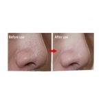 چسب پاک کننده بینی ویونسا